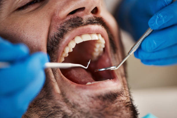 Best Tooth Infection Emergency Dentist  in Kings Beach, CA