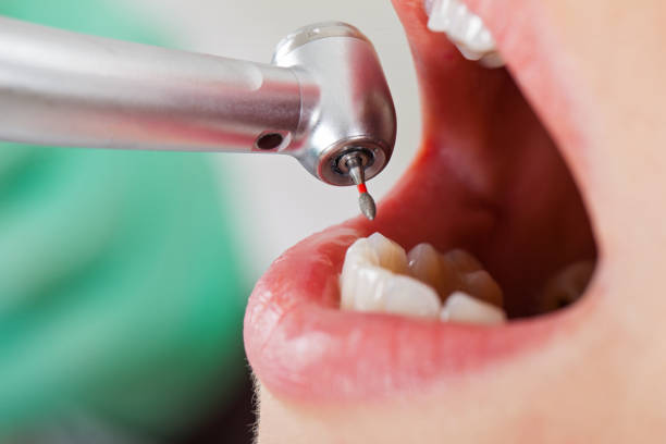 Best Root Canal Emergency Dentist  in Kings Beach, CA